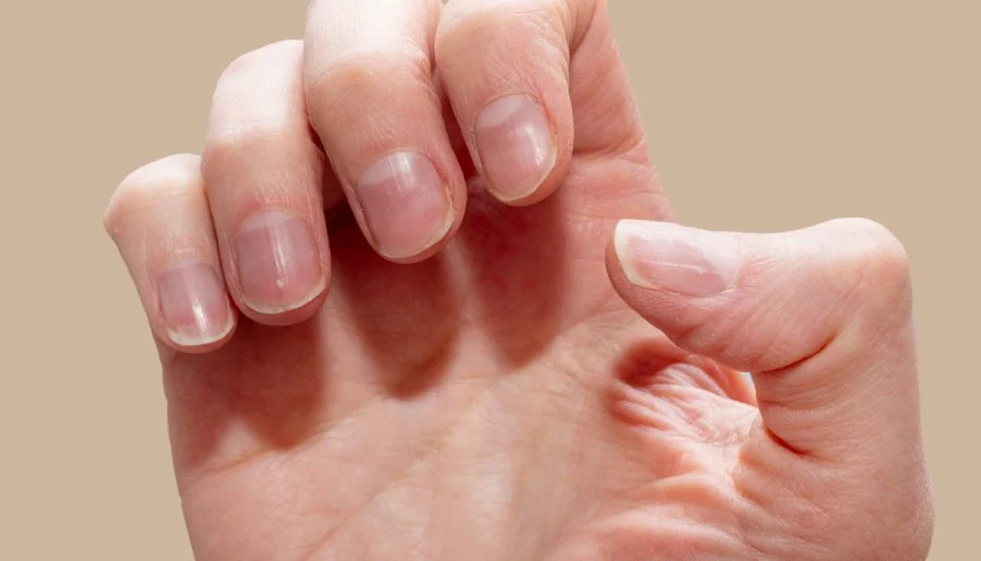 7 nail colour changes doctors say you shouldn’t ignore